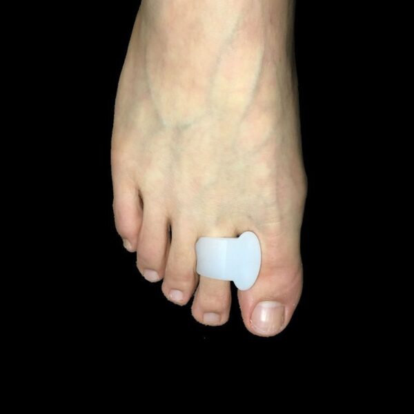 Toe Correction Silicone Insole Clip Toe Pad Orthopedic Milky White Toe Middle Finger Stall Toe Separator - Image 6